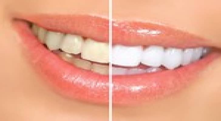 كيف تحصل على ابتسامة بيضاء ؟