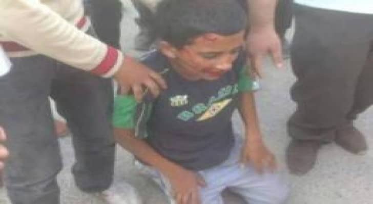 مستوطن يدهس طفلا بنابلس ويلوذ بالفرار