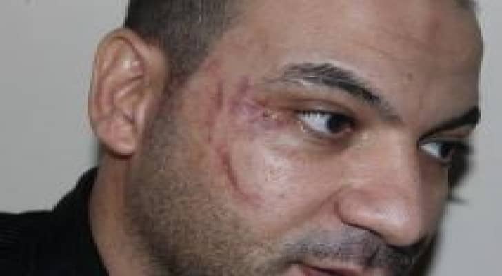 القنصل المصري  : خالد السيد لم يسقط حقه الشخصي