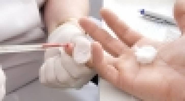 نتائج فحص الدم المأخوذ من الأصبع لا يمكن الاعتماد عليها