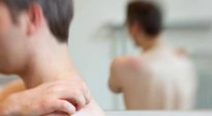 مجموعات البثور الصغيرة تنذر بالحزام الناري