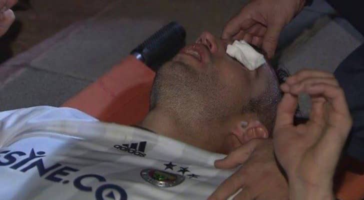 فان بيرسي يتعرض لإصابة خطيرة 
