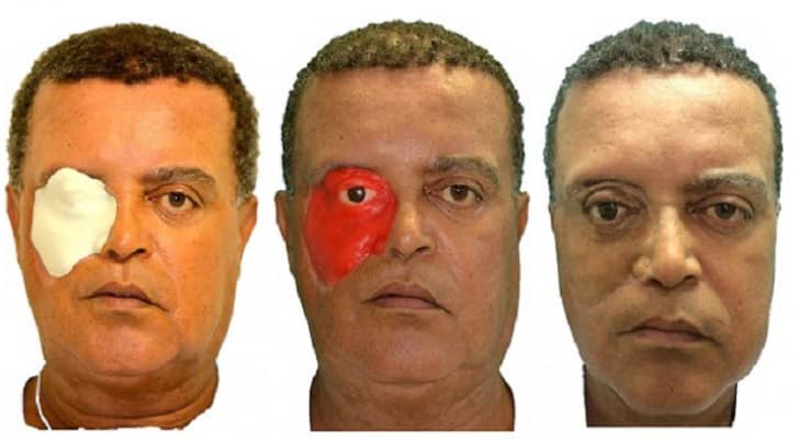  أول شخص في العالم يحصل على وجه مطبوع بتقنية 3D