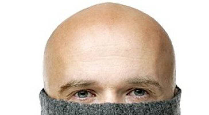 7 أسباب تؤدى بالرجال إلى الصلع فى سن مبكرة.. تعرف عليها