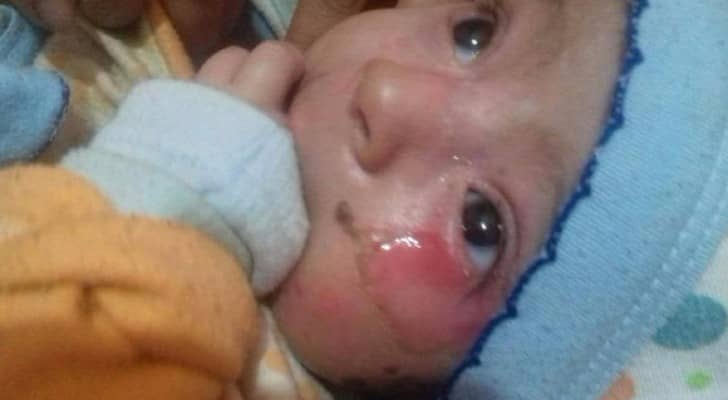 الرضيع مصاب بمرض نادر منذ ولادته