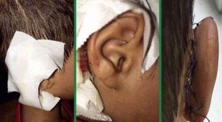معلم يعاقب طفلا بخلع أذنه