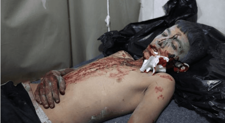 احد المصابين جراء القصف على ادلب