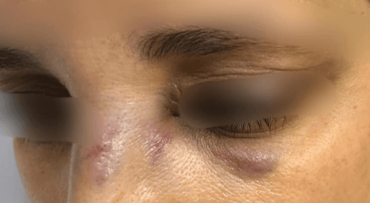 صورة الزوجة المعنفة من قبل زوجها كما نشرتها الناشطة