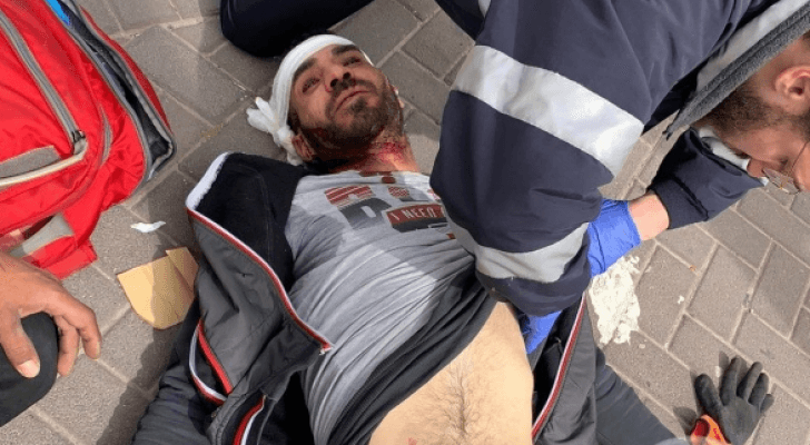مستوطنون يعتدون على شابين مقدسيين بالآلات الحادة والغاز
