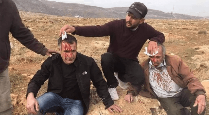 مسن فلسطيني ونجله أصيبا بالرأس إثر اعتداء المستوطنين