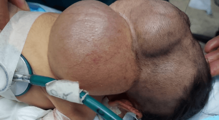 رأس المولودة