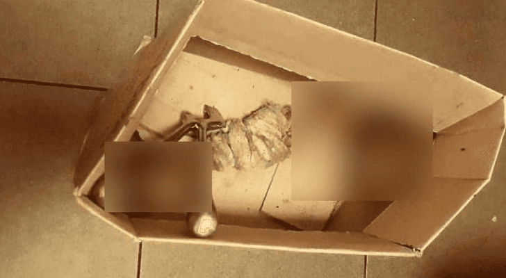 القدم بترت نتيجة عملية جراحية