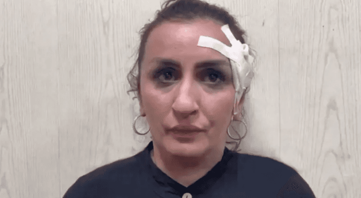 الأم الروسية التي باعت طفلها مقابل إجراء عملية تجميل لأنفها