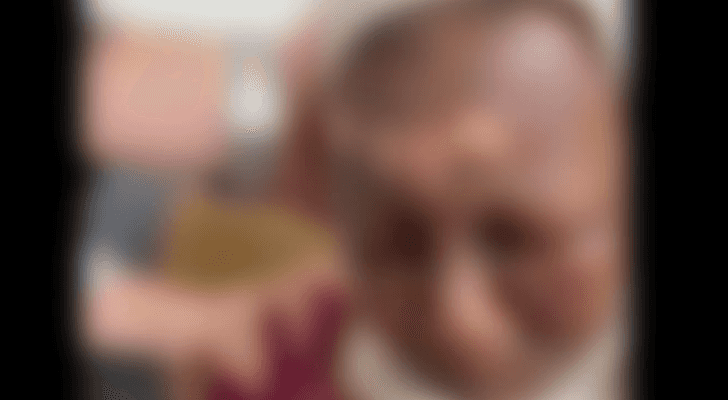 صورة للمسنة عقب تعرضها للحرق