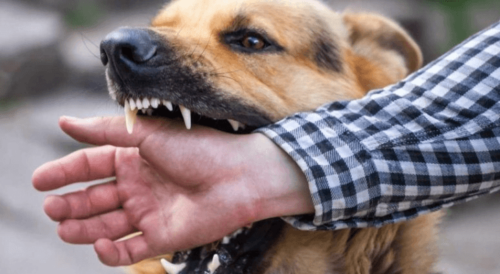 صورة تعبيرية لعقر كلب شخص بيده