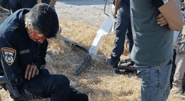 أحد عناصر شرطة الاحتلال عقب الحادث