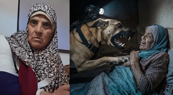 سيدة فلسطينية تعرضت لهجوم كلب للاحتلال