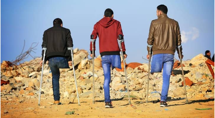 شباب يعانون من بتر في الساق