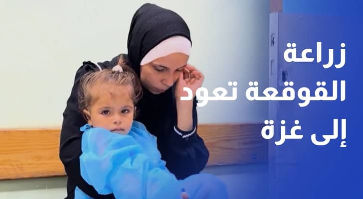 بعد أكثر من 3 سنوات.. زراعة القوقعة تعود إلى غزة وتمنح الأطفال فرصة للسمع